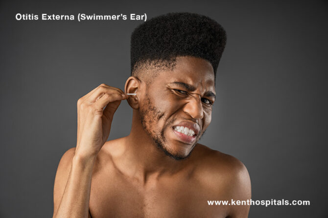 Swimmer’s Ear (Otitis Externa) - https://www.kenthospitals.com Swimmer ...